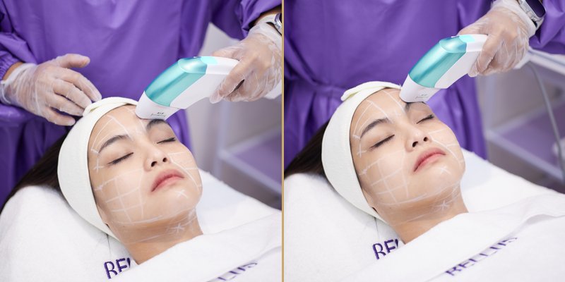 Bellus Clinical Transformation