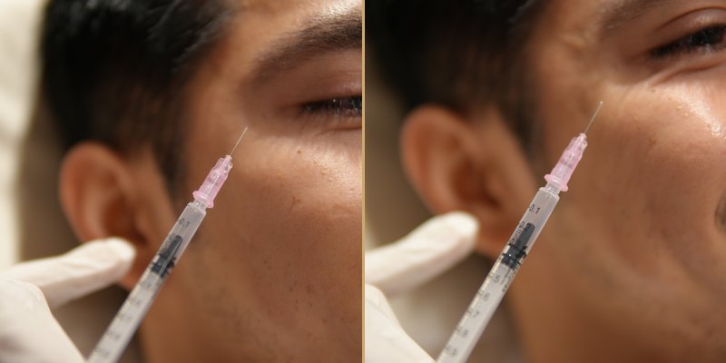 Bellus Clinical Transformation