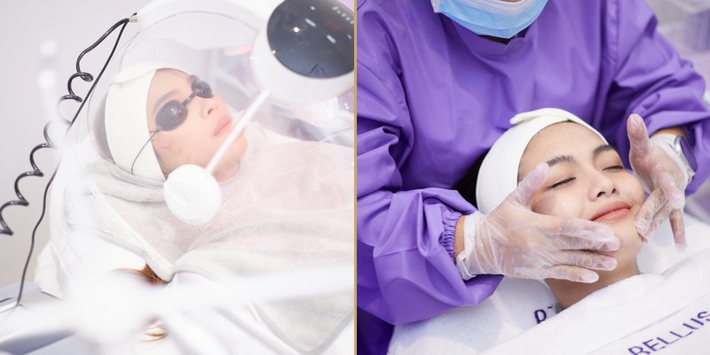 Bellus Clinical Transformation