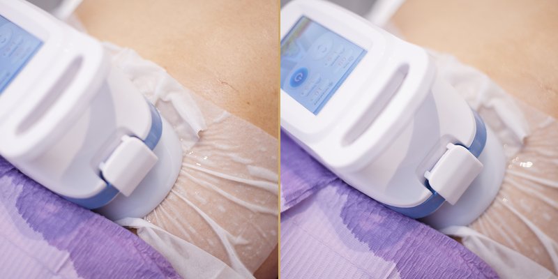 Bellus Clinical Transformation